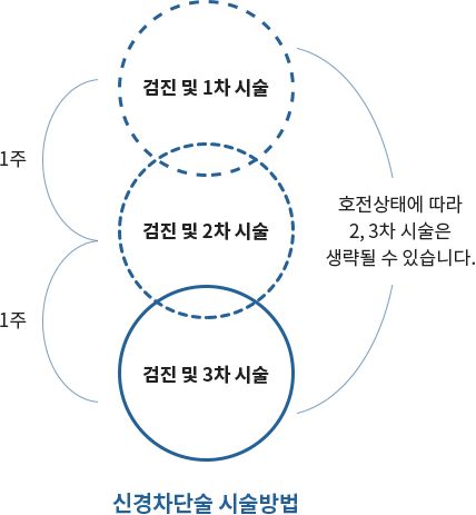 신경차단술 시술방법. 검진 및 1차 시술, 검진 및 2차 시술, 검진 및 3차 시술. 호전상태에 따라 2, 3차 시술은 생략될 수 있습니다.